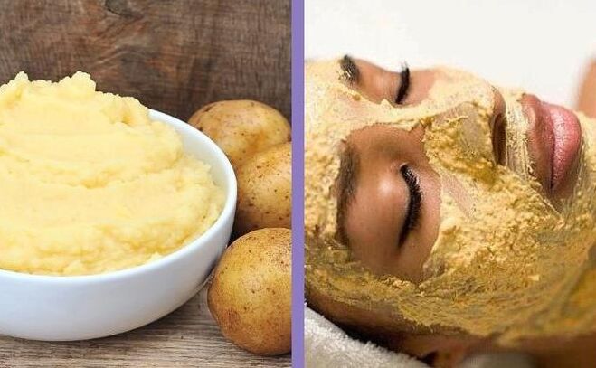 Ниқоби картошка